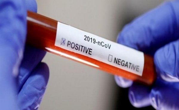 صورة 977  اصابة جديدة بكورونا من ضمنها 81 في لعصابة