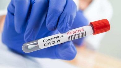 صورة موريتانيا خريطة انتشار جائحة كوفيد